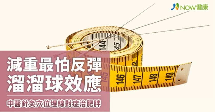 減重最怕反彈溜溜球效應 中醫針灸穴位埋線對症治肥胖