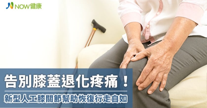 告別膝蓋退化疼痛！ 新型人工膝關節幫助恢復行走自如