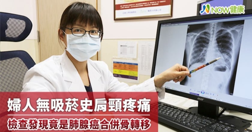 婦人無吸菸史肩頸疼痛 檢查發現竟是肺腺癌合併骨轉移
