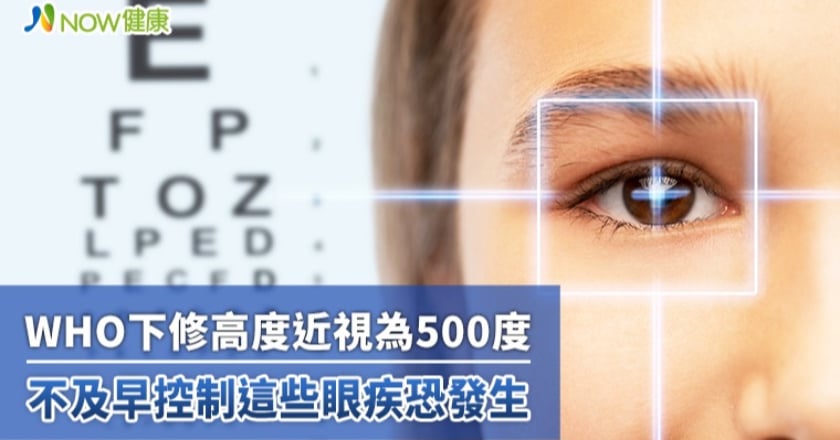 WHO下修高度近視為500度 不及早控制這些眼疾恐發生