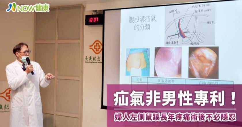 疝氣非男性專利! 婦人左側鼠蹊長年疼痛術後不必隱忍