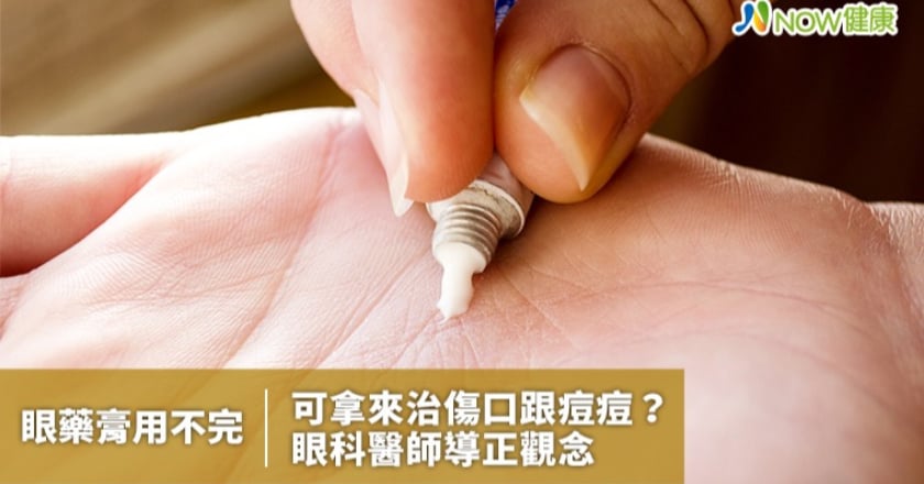 眼藥膏用不完可拿來治傷口跟痘痘? 眼科醫師導正觀念