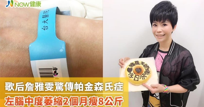歌后詹雅雯驚傳帕金森氏症 10大症狀有3項應提高警覺