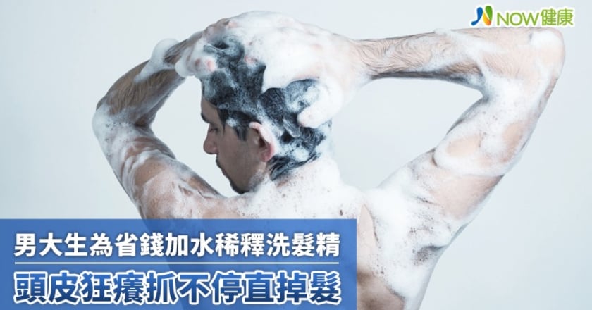 男大生為省錢加水稀釋洗髮精! 頭皮狂癢抓不停直掉髮