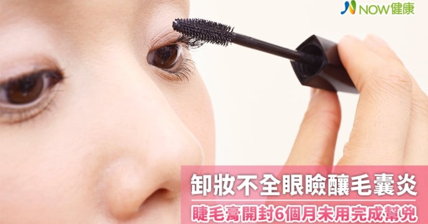 卸妝不全眼瞼釀毛囊炎 睫毛膏開封6個月未用完成幫兇