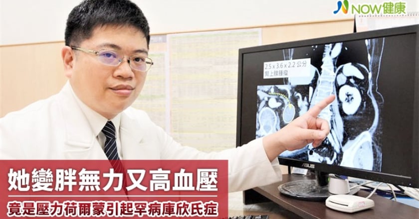 她變胖無力又高血壓 竟是壓力荷爾蒙引起罕病庫欣氏症