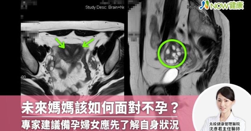 《未來媽媽》獲好評 專家建議備孕婦女應先做好這件事