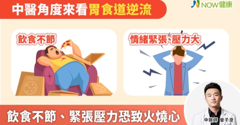 不只是火燒心！ 中醫師曝這些胃食道逆流症狀也別大意