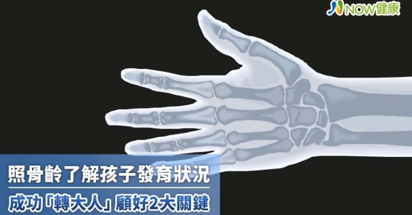 照骨齡了解孩子發育狀況 成功「轉大人」顧好2大關鍵