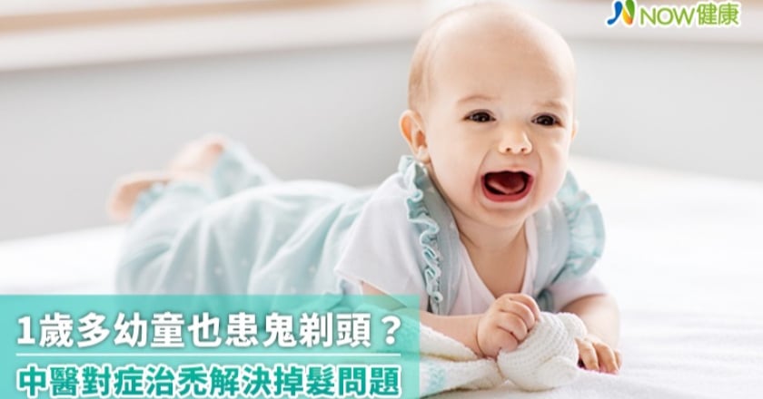 1歲多幼童也患鬼剃頭？ 中醫對症治禿解決掉髮問題
