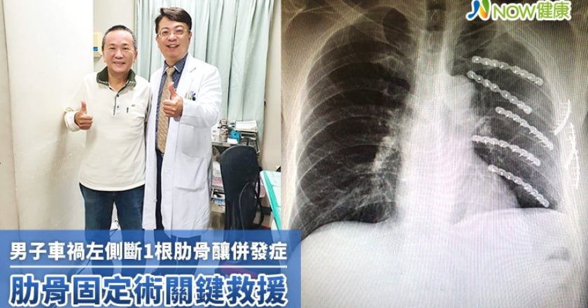男子車禍左側斷1根肋骨釀併發症 肋骨固定術關鍵救援