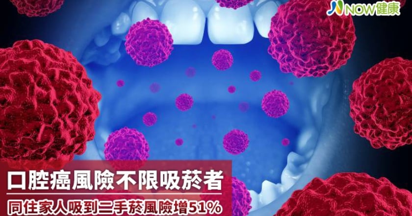 口腔癌風險不限吸菸者 同住家人吸到二手菸風險增51%
