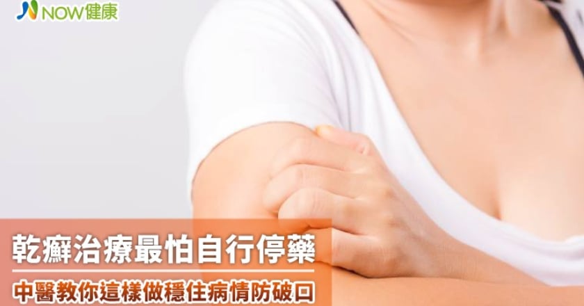 乾癬治療最怕自行停藥 中醫教你這樣做穩住病情防破口