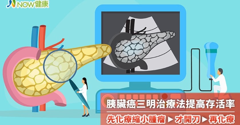 胰臟癌三明治療法新趨勢 先化療縮小腫瘤才開刀再化療