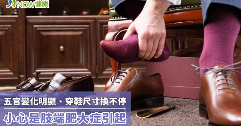 五官變化明顯、穿鞋尺寸換不停 小心是肢端肥大症引起