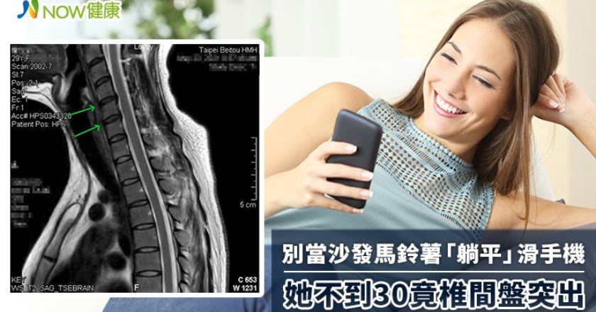 別當沙發馬鈴薯「躺平」滑手機 她不到30竟椎間盤突出