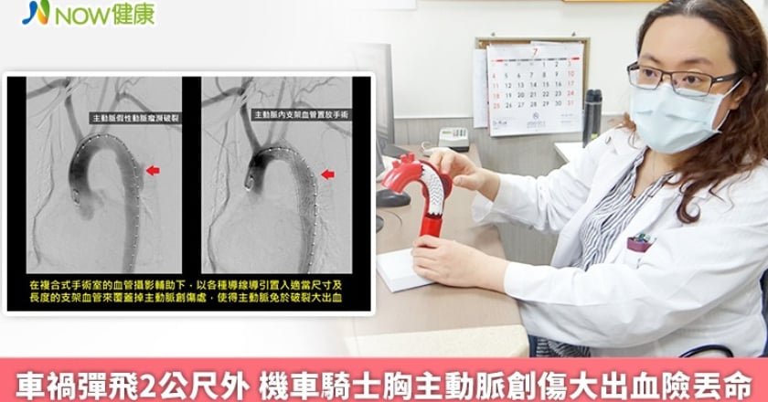 車禍彈飛2公尺外 機車騎士胸主動脈創傷大出血險丟命