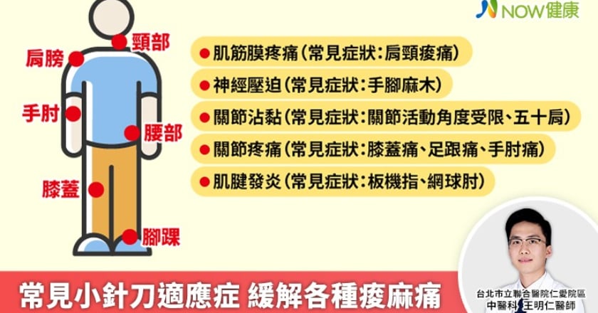 3C產品導致頸椎病年輕化 中醫小針刀緩解各種痠麻痛