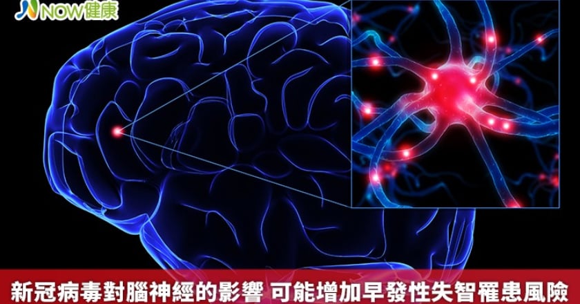 新冠病毒對腦神經的影響 可能增加早發性失智罹患風險