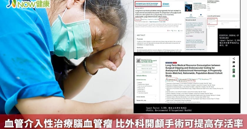 血管介入性治療腦血管瘤 比外科開顱手術可提高存活率