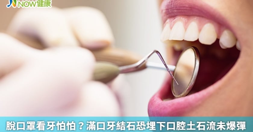 脫口罩看牙怕怕? 滿口牙結石恐埋下口腔土石流未爆彈