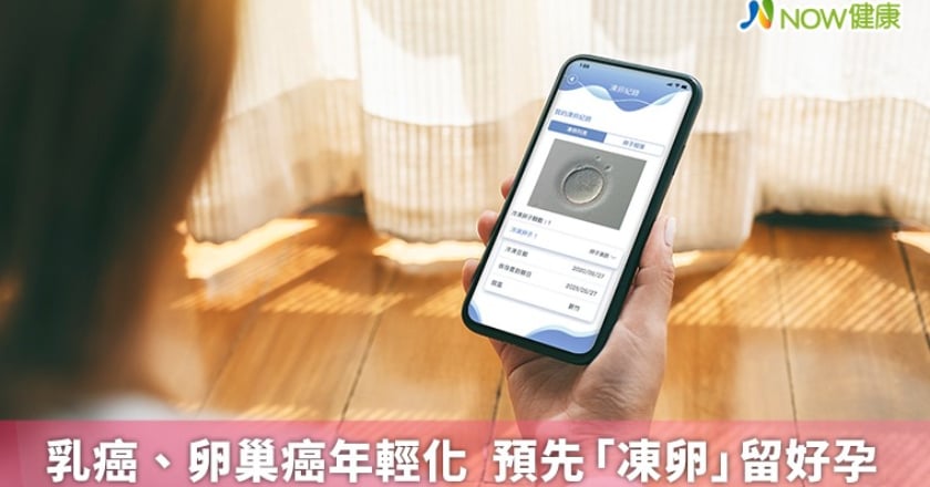 乳癌、卵巢癌年輕化 預先「凍卵」留好孕