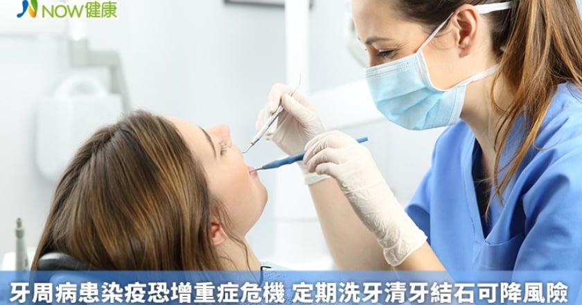 牙周病患染疫恐增重症危機 定期洗牙清牙結石可降風險