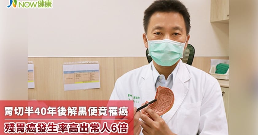胃切半40年後解黑便竟罹癌 殘胃癌發生率高出常人6倍