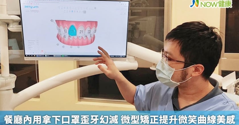餐廳內用拿下口罩歪牙幻滅 微型矯正提升微笑曲線美感