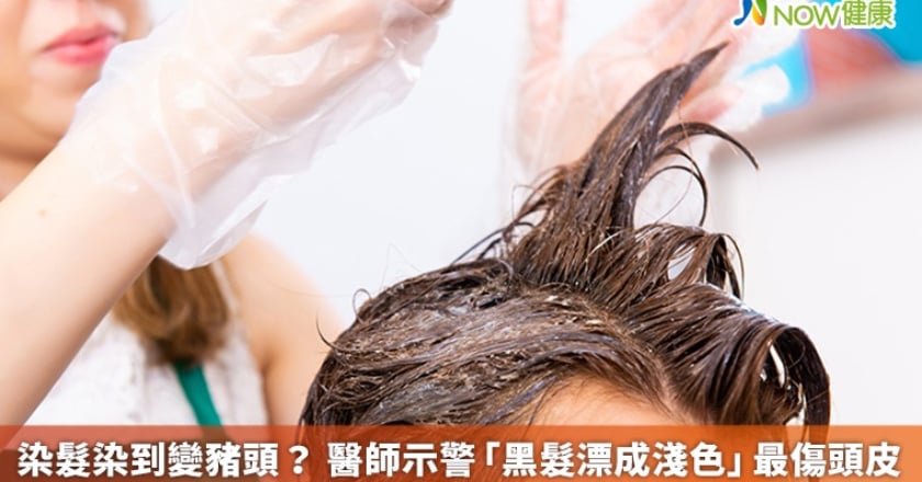 染髮染到變豬頭？ 醫師示警「黑髮漂成淺色」最傷頭皮