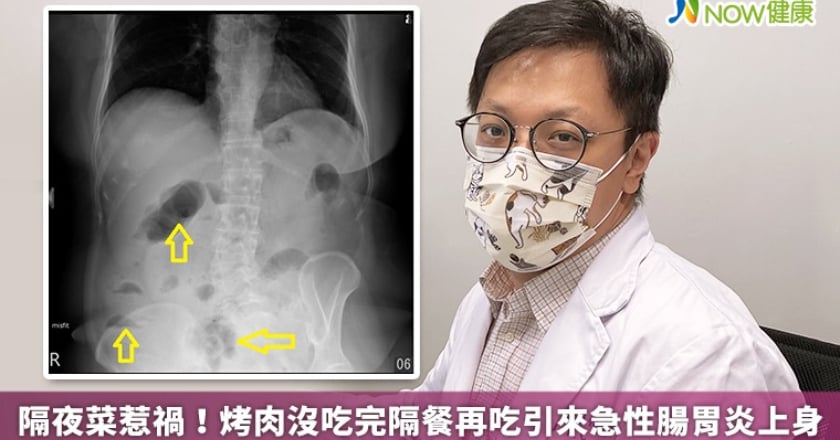 隔夜菜惹禍! 烤肉沒吃完隔餐再吃引來急性腸胃炎上身