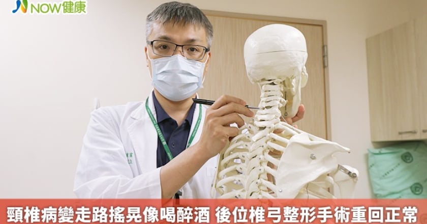 頸椎病變走路搖晃像喝醉酒 後位椎弓整形手術重回正常