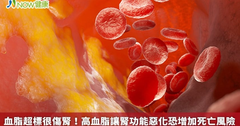 血脂超標很傷腎！ 高血脂讓腎功能惡化恐增加死亡風險