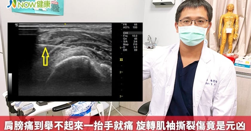 肩膀痛到舉不起來一抬手就痛 旋轉肌袖撕裂傷竟是元凶
