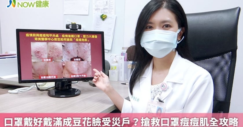 口罩戴好戴滿成豆花臉受災戶？ 搶救口罩痘痘肌全攻略