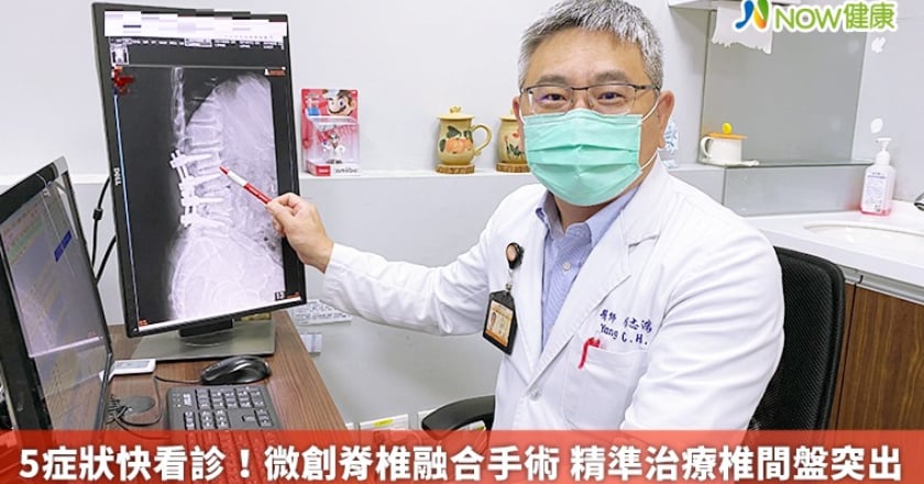 5症狀快看診!微創脊椎融合手術 精準治療椎間盤突出
