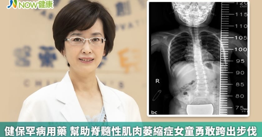健保罕病用藥 幫助脊髓性肌肉萎縮症女童勇敢跨出步伐