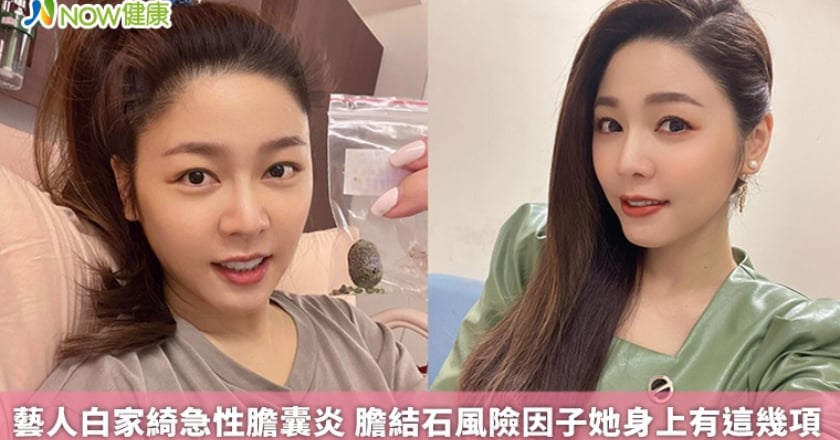 藝人白家綺急性膽囊炎 膽結石風險因子她身上有這幾項