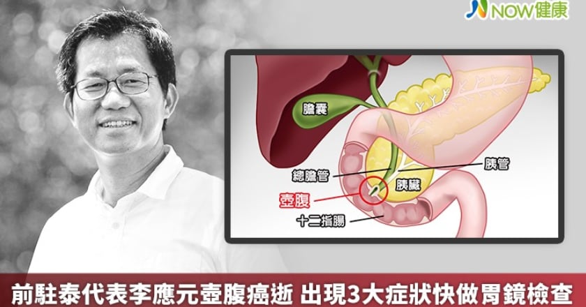 前駐泰代表李應元壺腹癌逝 出現3大症狀快做胃鏡檢查