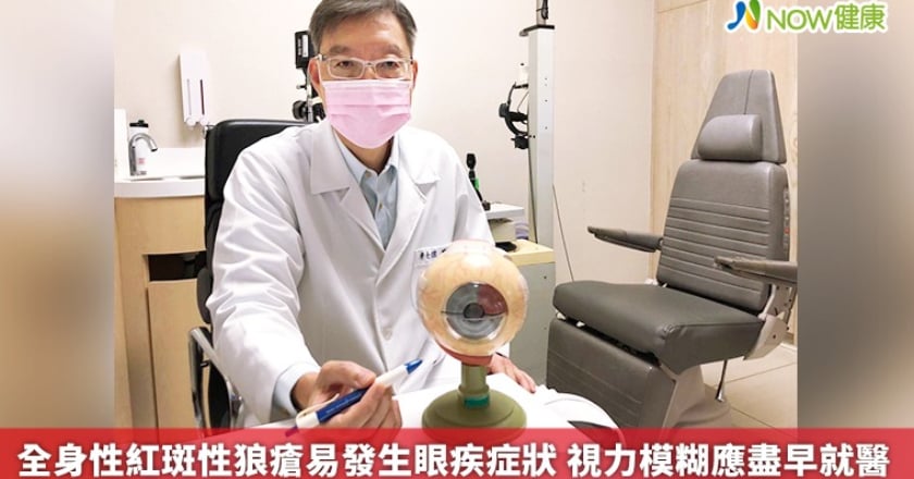 全身性紅斑性狼瘡易發生眼疾症狀 視力模糊應盡早就醫