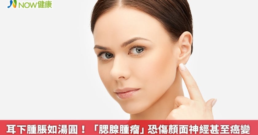 耳下腫脹如湯圓! 「腮腺腫瘤」恐傷顏面神經甚至癌變