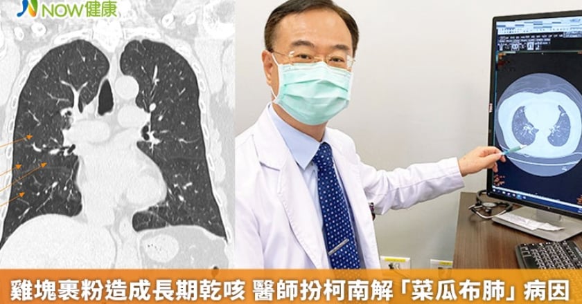雞塊裹粉造成長期乾咳 醫師扮柯南解「菜瓜布肺」病因