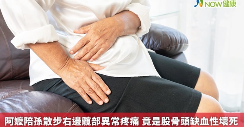 阿嬤陪孫散步右邊髖部異常疼痛 竟是股骨頭缺血性壞死