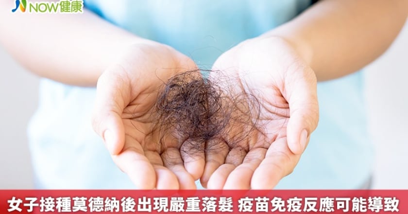 女子接種莫德納後出現嚴重落髮 疫苗免疫反應可能導致