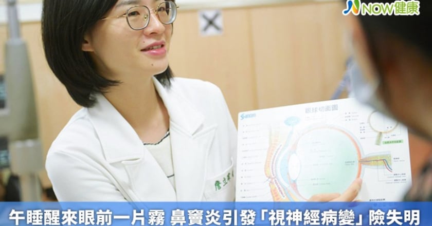 午睡醒來眼前一片霧 鼻竇炎引發「視神經病變」險失明