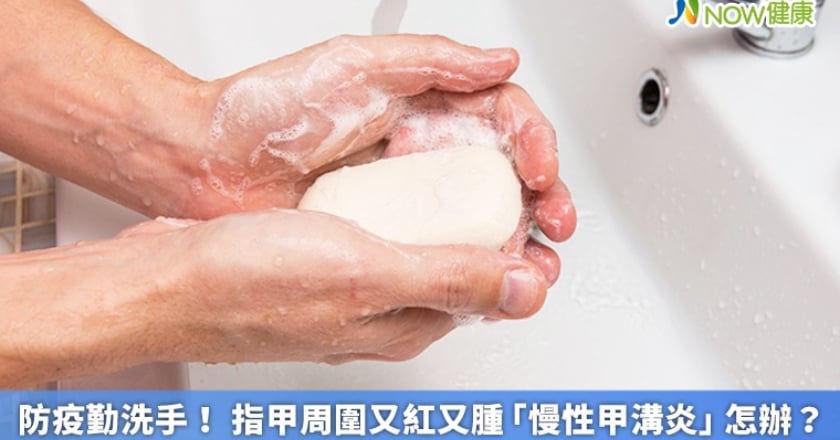 防疫勤洗手！ 指甲周圍又紅又腫「慢性甲溝炎」怎辦？