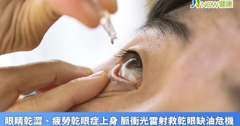 眼睛乾澀、疲勞乾眼症上身 脈衝光雷射救乾眼缺油危機