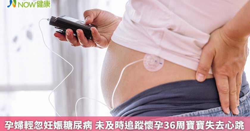 孕婦輕忽妊娠糖尿病 未及時追蹤懷孕36周寶寶失去心跳