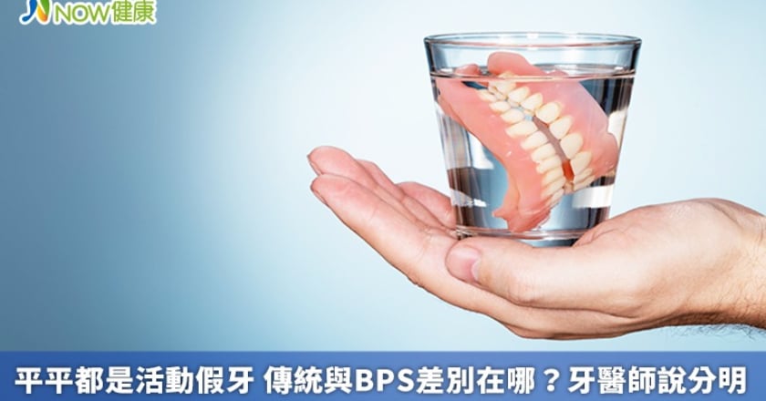 平平都是活動假牙 傳統與BPS差別在哪?牙醫師說分明