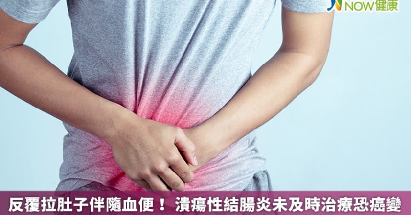 反覆拉肚子伴隨血便! 潰瘍性結腸炎未及時治療恐癌變